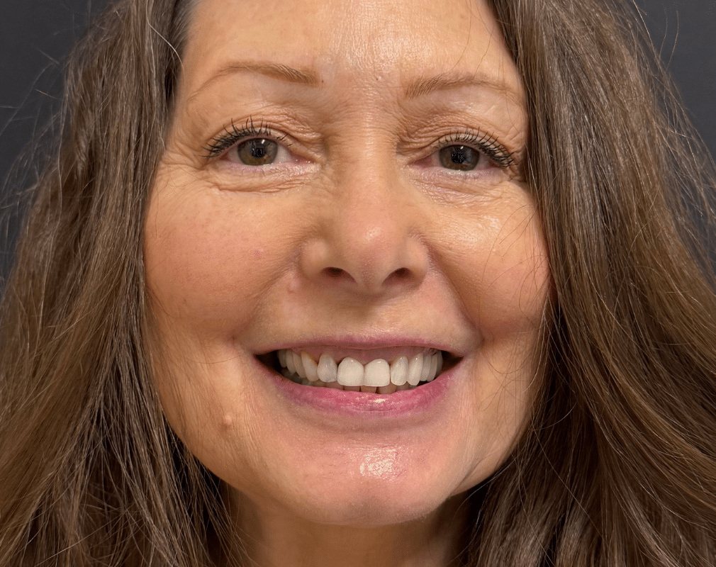 Smiling woman with long hair