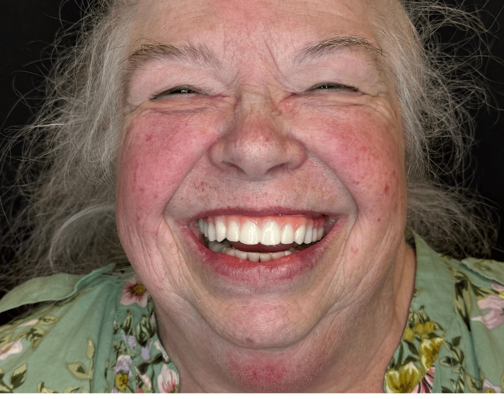 Smiling woman with gray hair